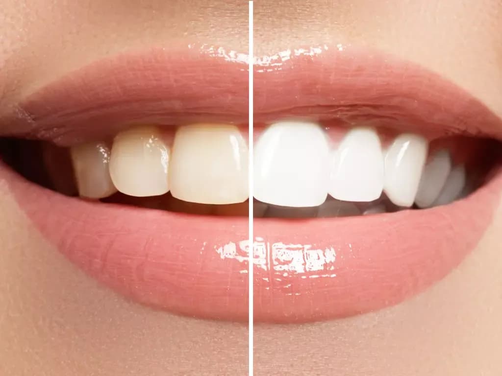 Najlepsza Pasta Wybielająca: Ranking Past Wybielających dla Zdrowych i Białych Zębów